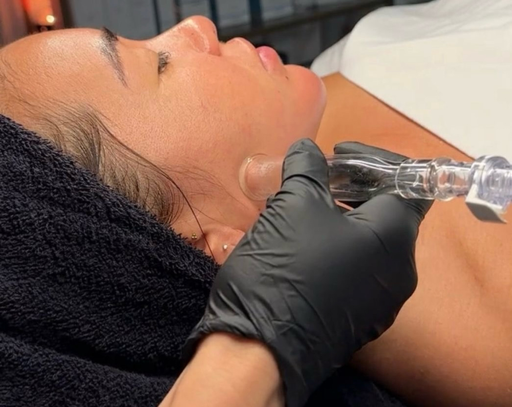 Platinum Lymphatic Hydrafacial at VOGUE AESTHETICS in Okeechobee, FL