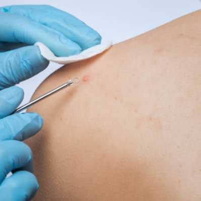 Back Facial at Flourish Health & Wellness in Howard City, MI