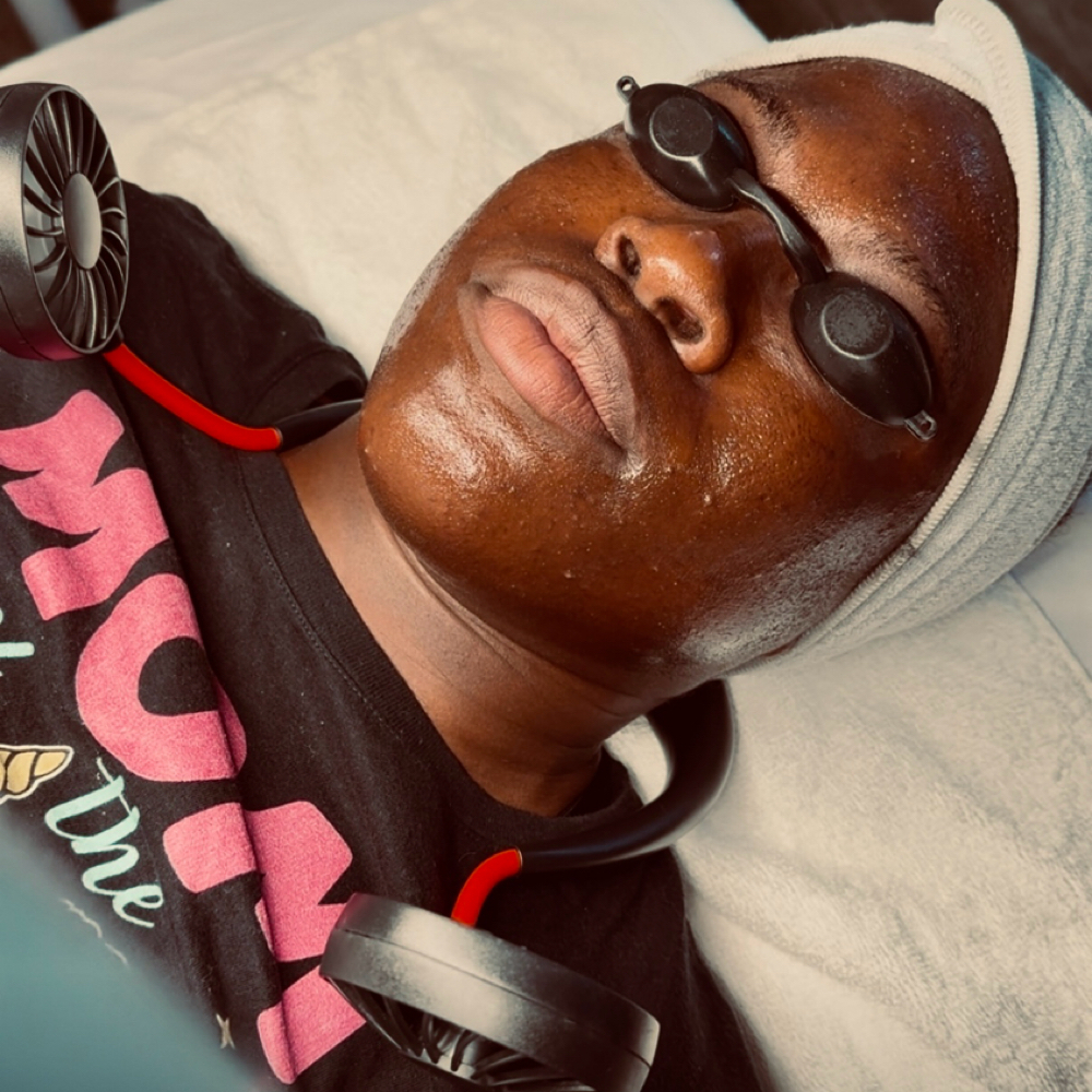 Chemical Treatment at Refinery Aesthetics Loft in Oxon Hill, MD