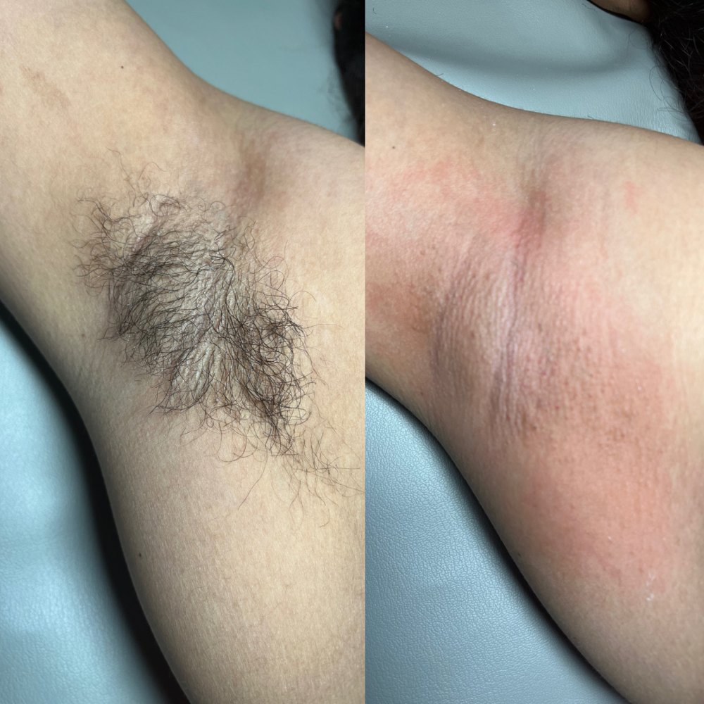 Under Arm Wax