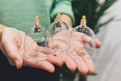 Cupping Therapy