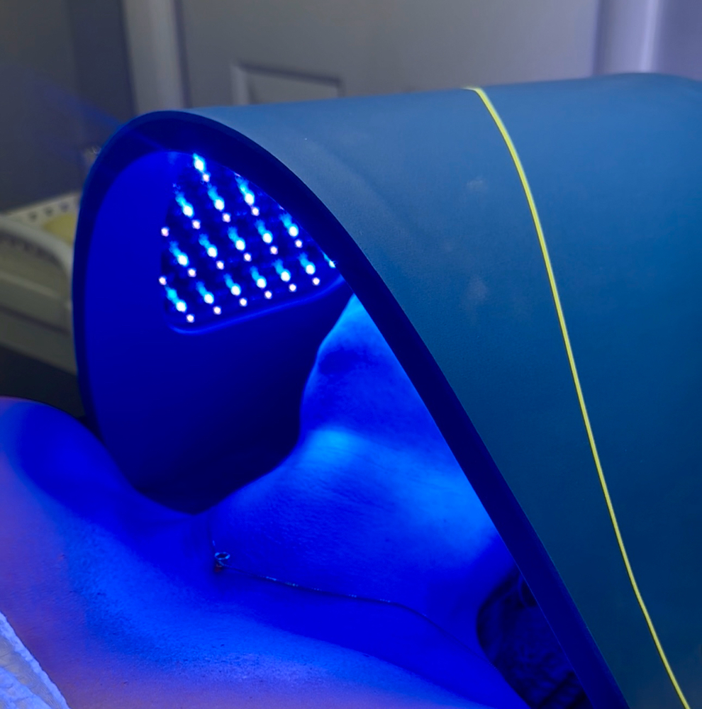 LED Light Therapy Facial