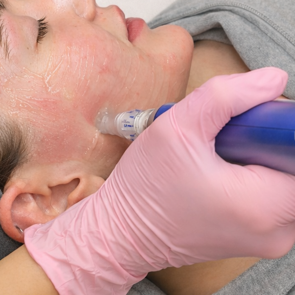 Microneedling — neck included at Ava Beauty Bar in Lehi, UT