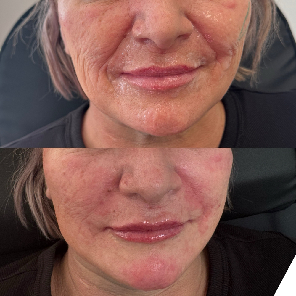 The Beauty Package at Aesthetic Beauty Bar, LLC By Haley in Tyler, TX