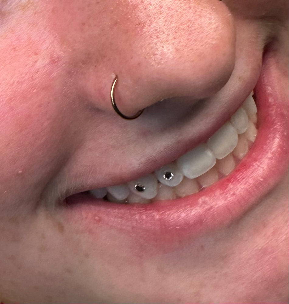 Tooth Gems