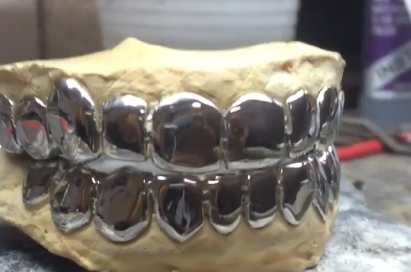 Silver Grill Priced Per Tooth