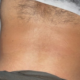 Lower Back Wax at Inclusive Esthetixs in CA, CA
