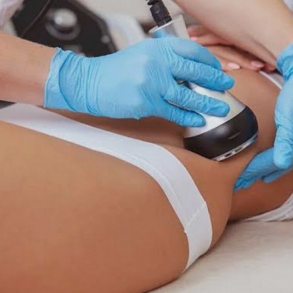 Radio Frequency Skin Tightening at Le Bar Beaute in Indian Trail, NC