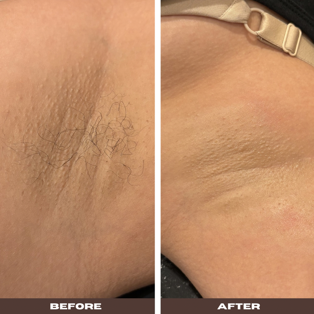 Underarm Wax at Britts Beauty Spa in Pico Rivera, CA
