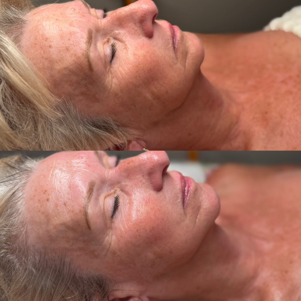 The Anti-Aging Facial at Margaux Ellen Esthetics in Pineville, LA
