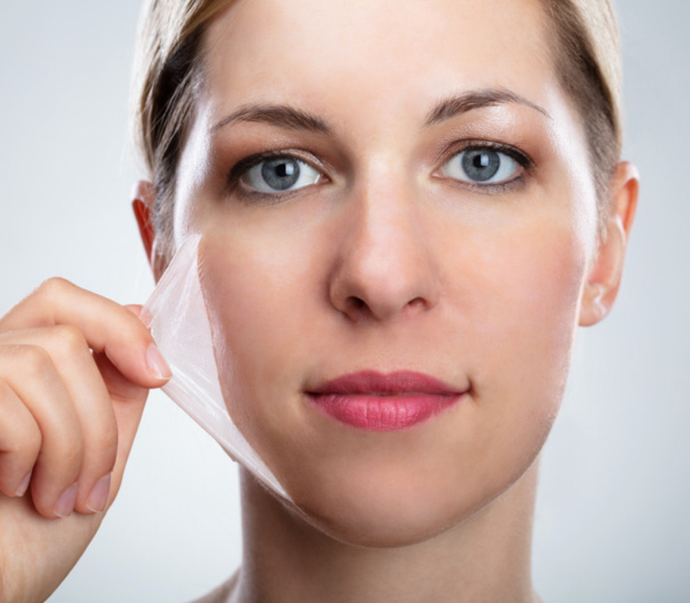 Chemical Peel