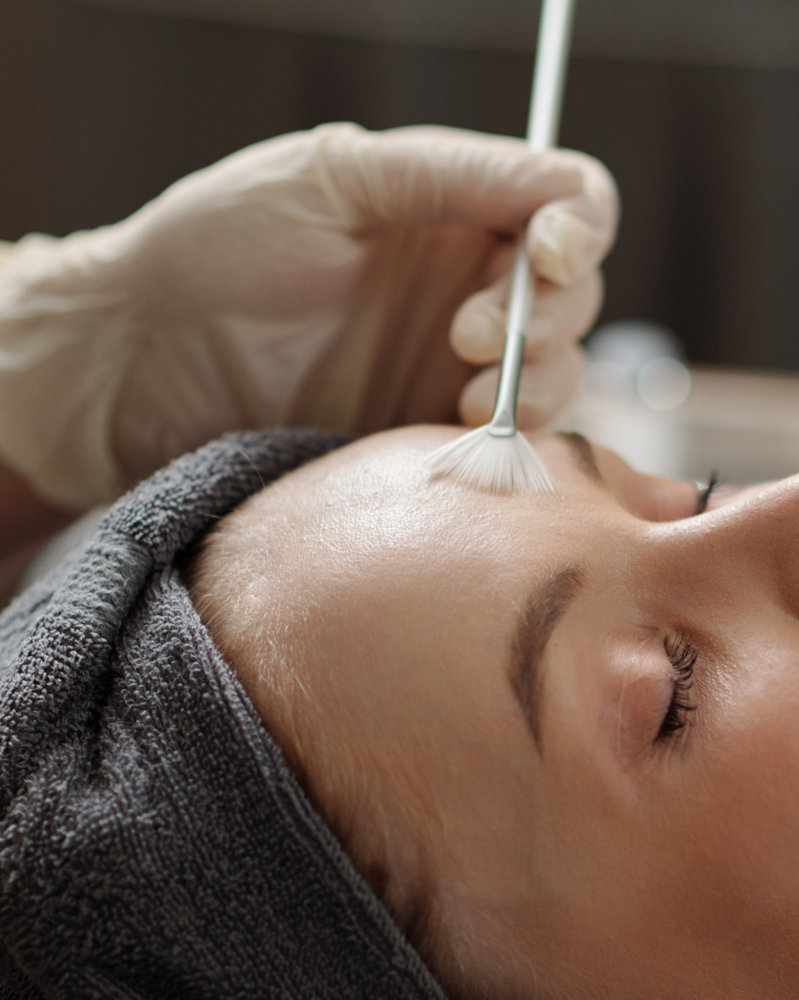 Blemish Control Peel