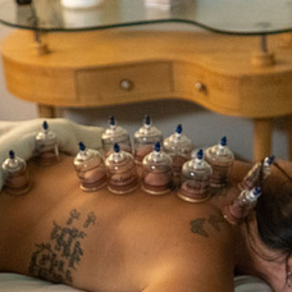 Cupping Therapy Add On at Evolve Massage Therapy & Spa in Richmond, KY