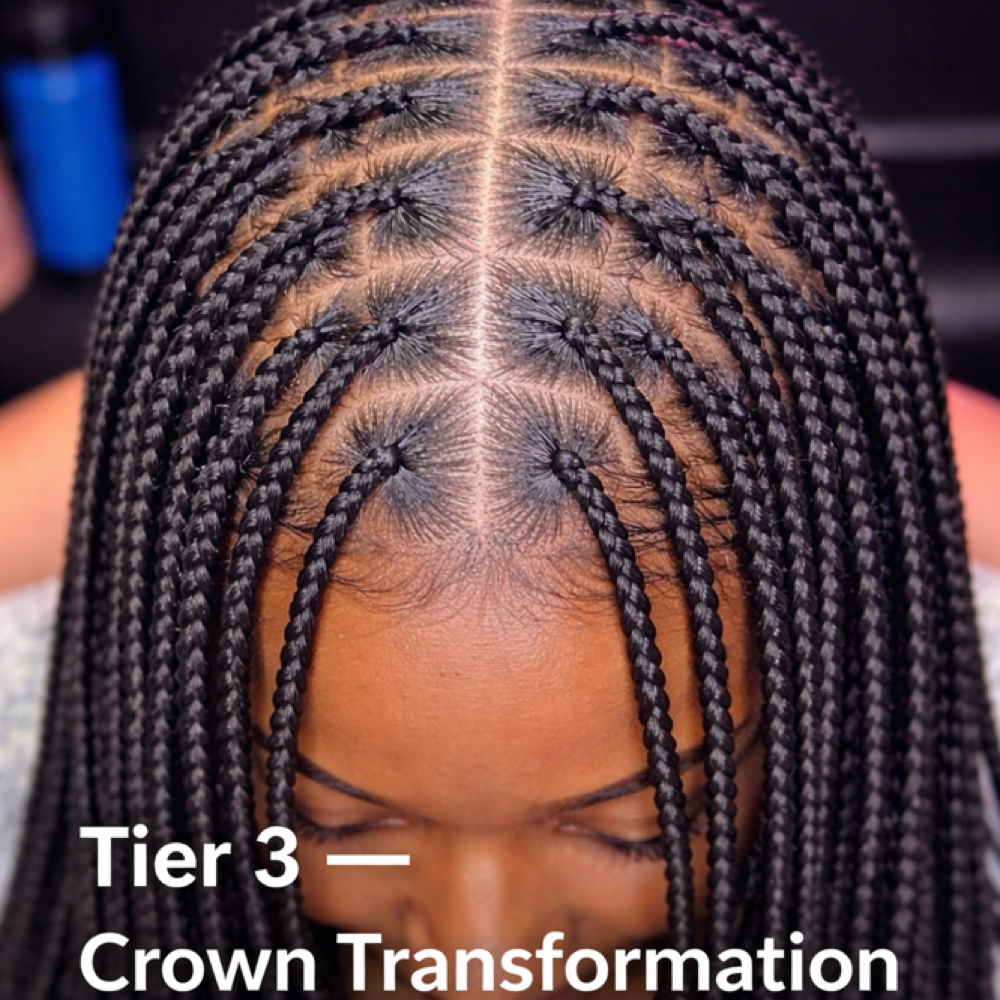 Tier 3 | Crown Transformation at Restoring Natural Beauty in Wilmington, DE