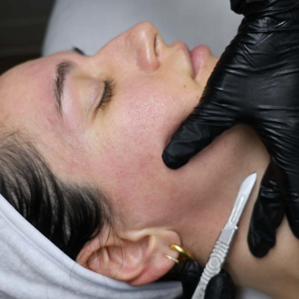 Express Dermaplane at Mugshot Skincare in Omaha, NE