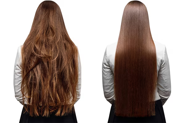 Keratin Lasio