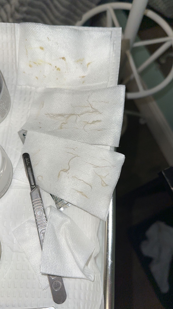 Add On Dermaplane