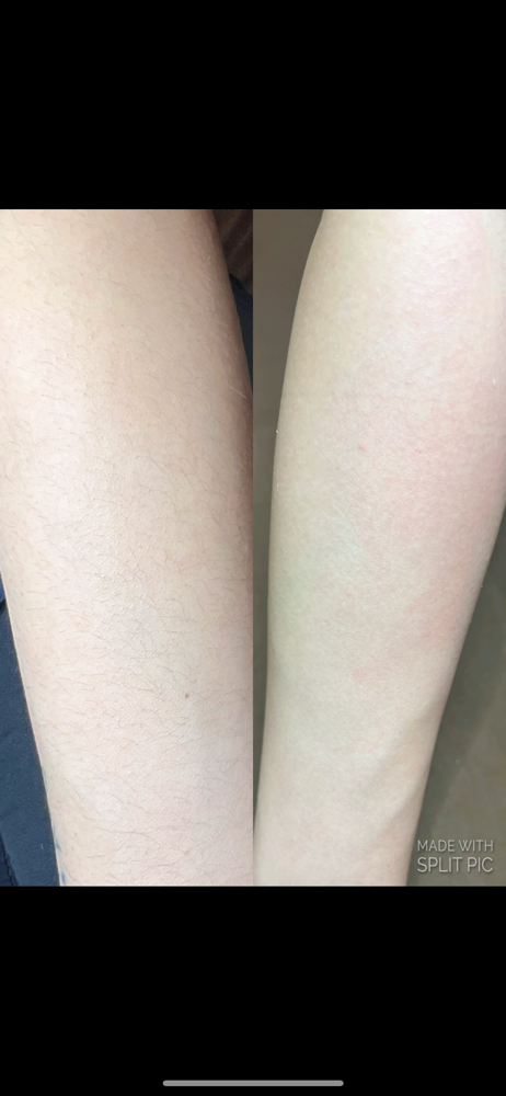 Full Arm Waxing