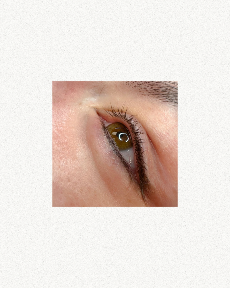 Eyelash Enhancement