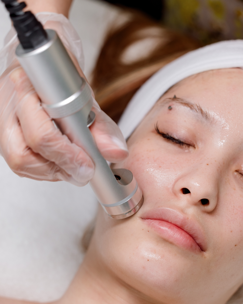 No Needle Mesotherapy Facial