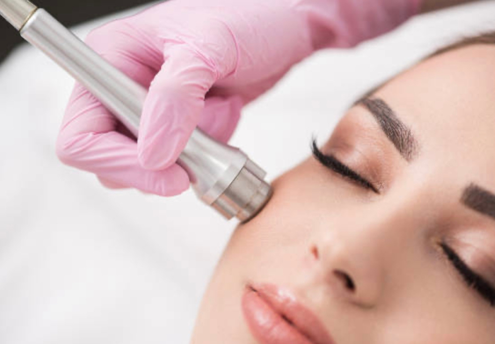 Microdermabrasion Facial