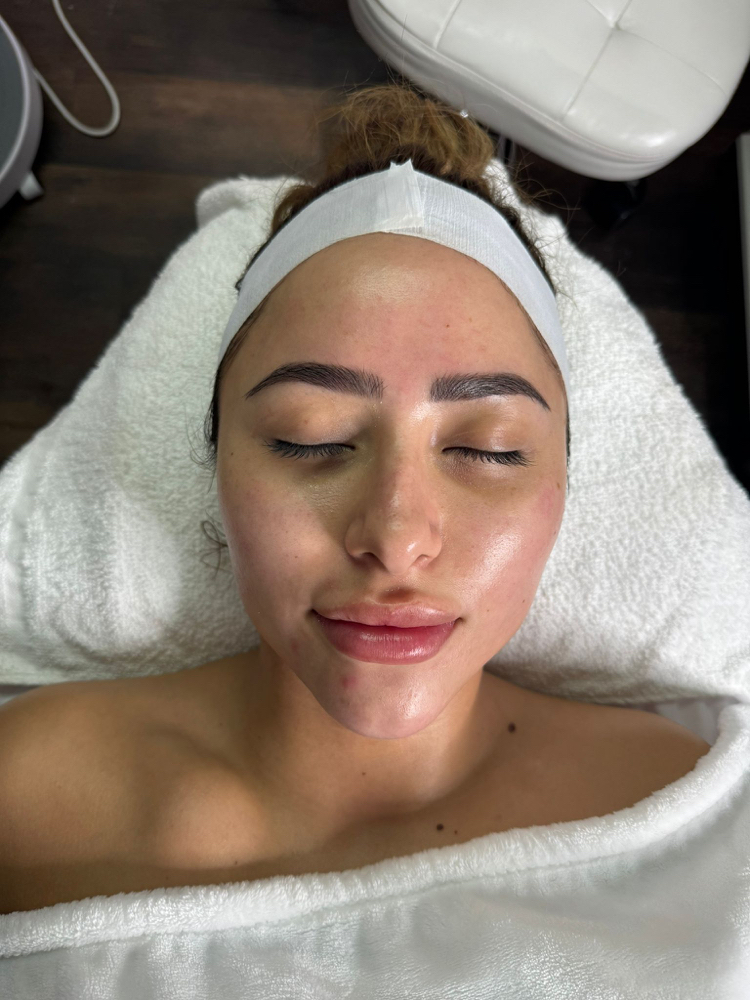 Dermaplane Facial