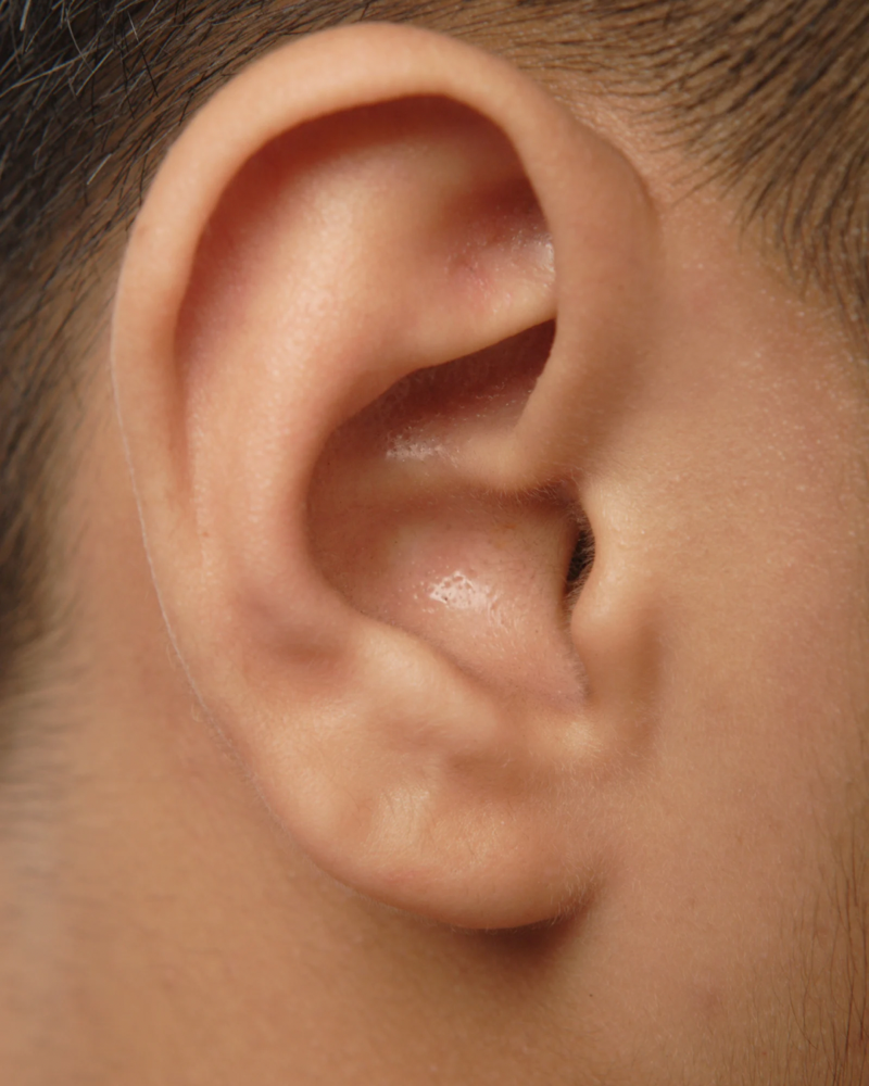 Ear Wax