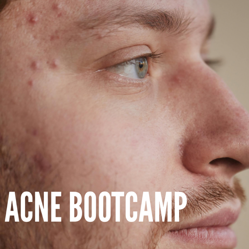 VIRTUAL ACNE CONSULTATION at AESTHETICSBYNATALY in Alhambra, CA