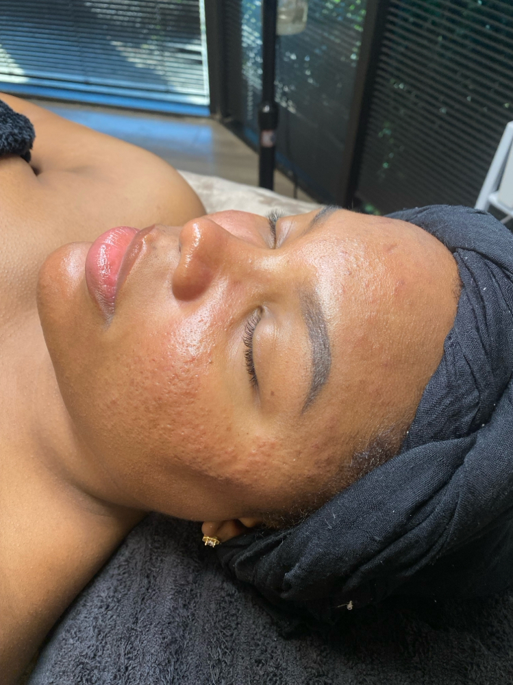Deep Pore Cleansing Facial at The V Bar in Houston, TX