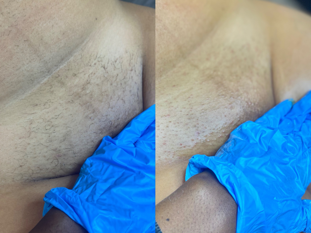 Brazilian Touch Up