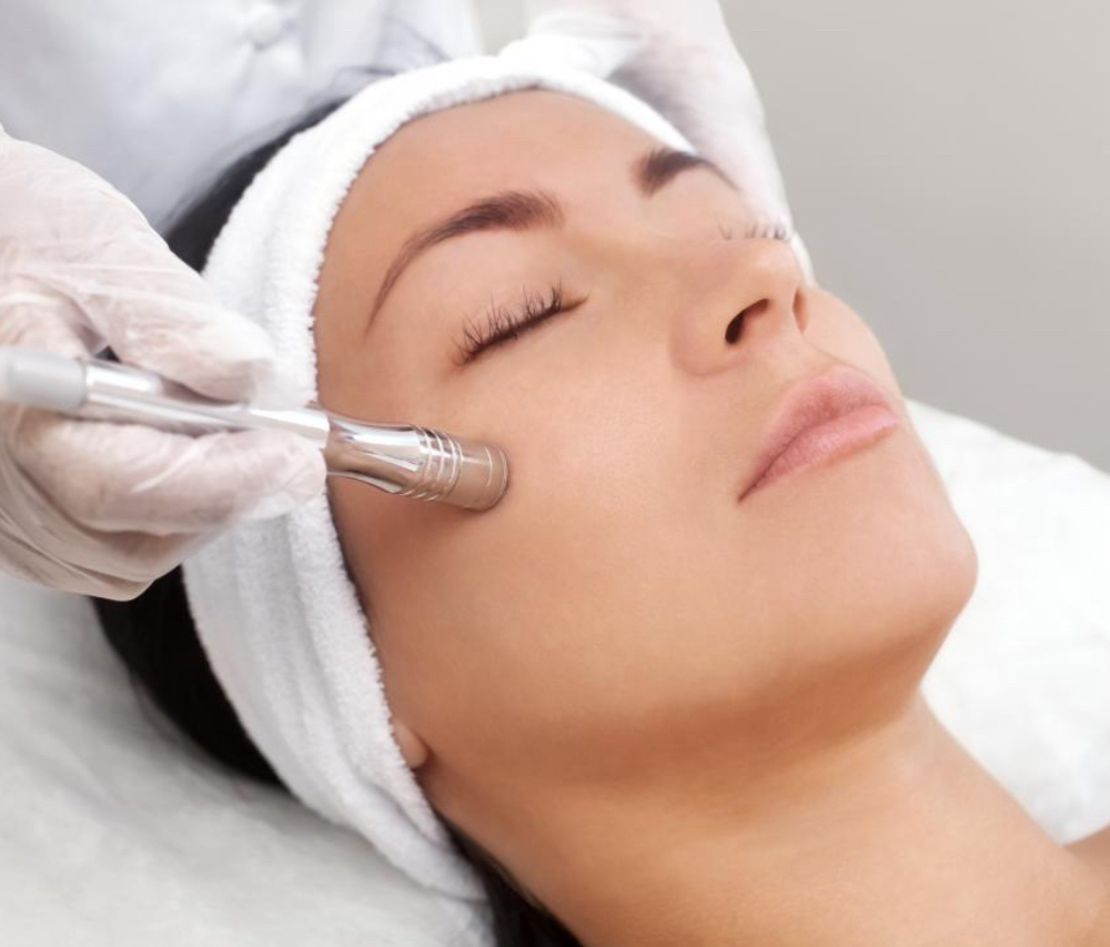 Microdermabrasion
