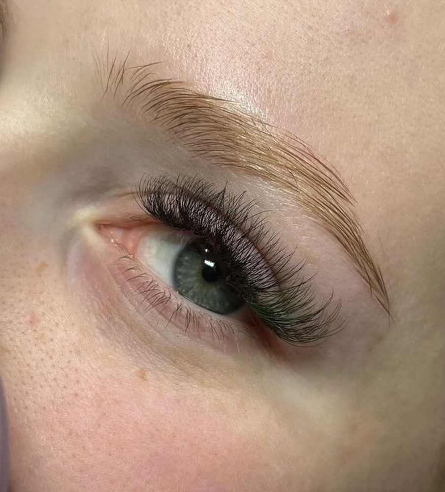 Volume Fill (8-21 days)