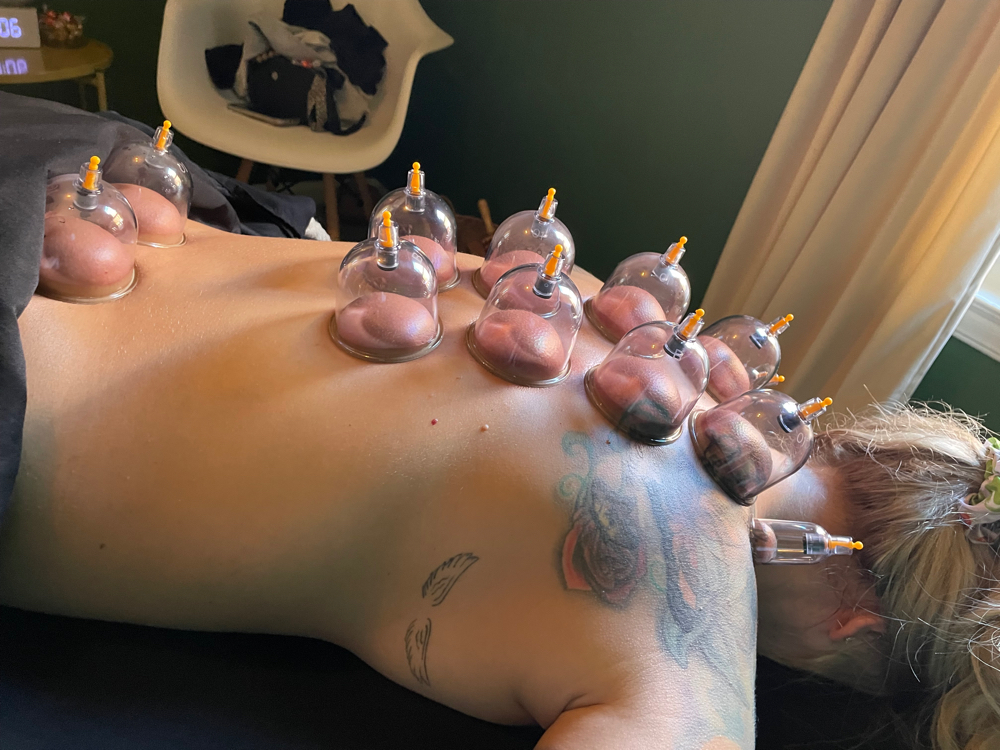 Cupping Add On! ✨