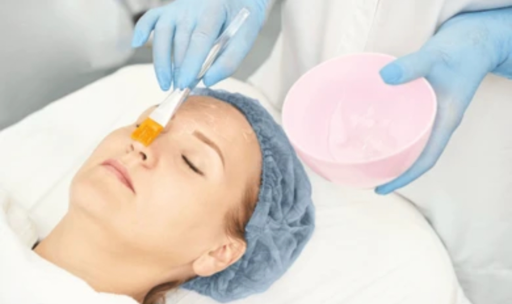 Customized Chemical Peel