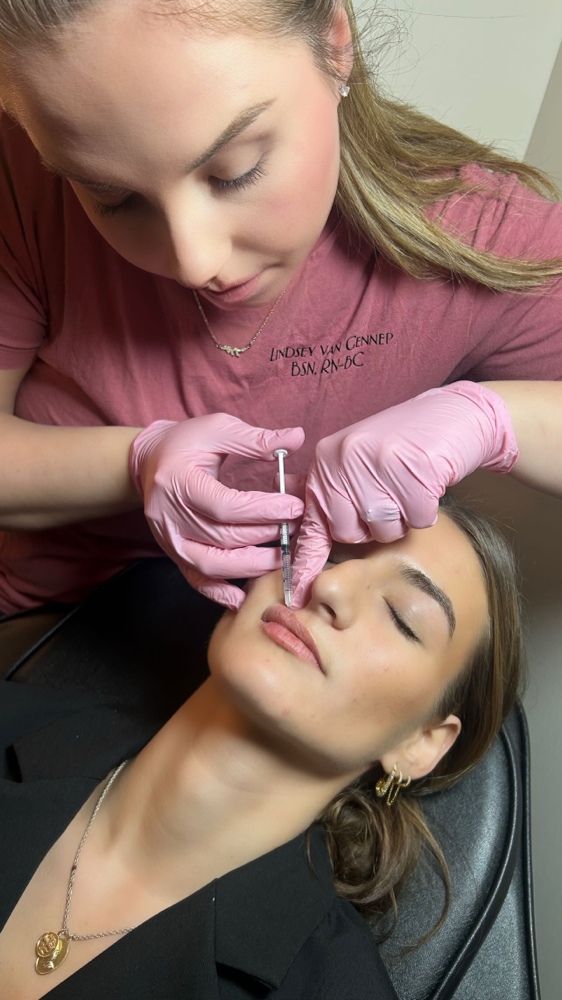 Lip Filler