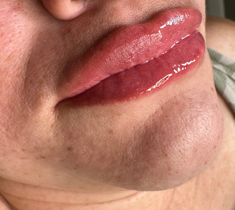 Lip Neutralization/color correction