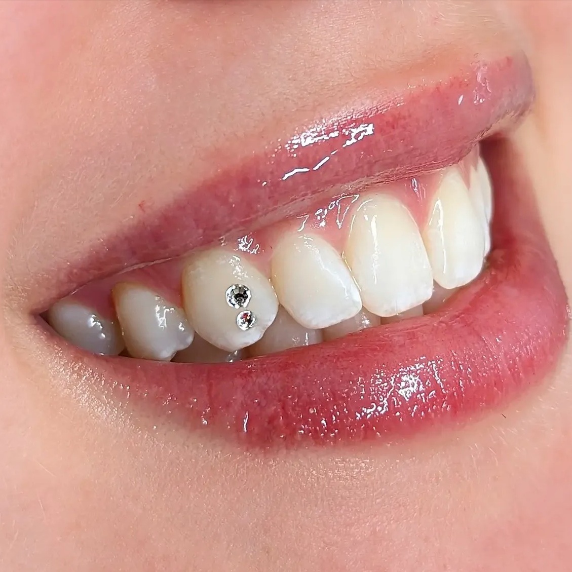 2 Tooth Gems (Swarovski Crystals) at Royal Blanc Smiles - Teeth Whitening and Tooth Gems in Charlotte, NC in Charlotte, NC