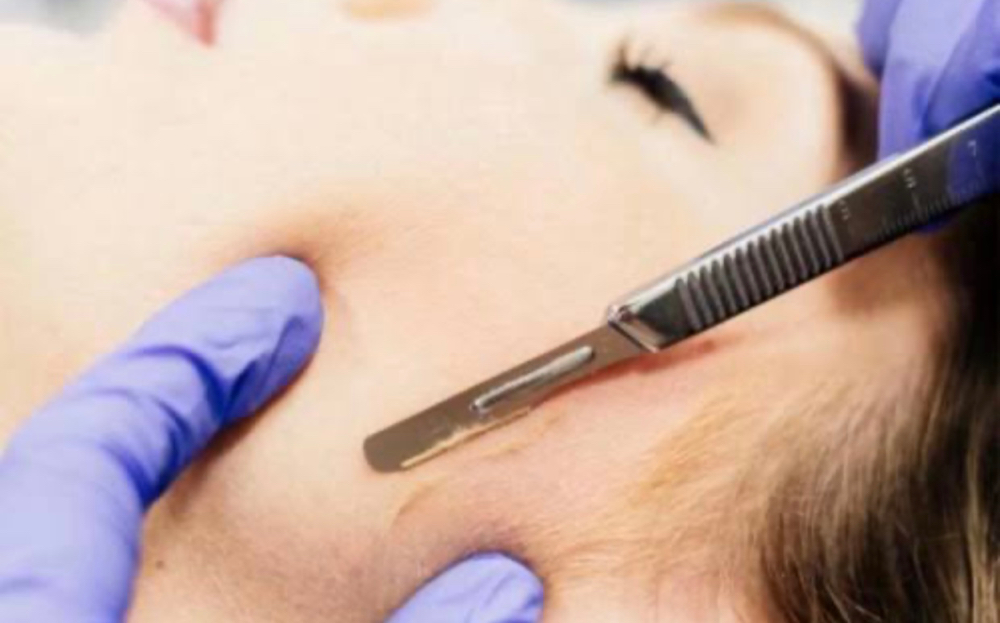 Dermaplaning Facial