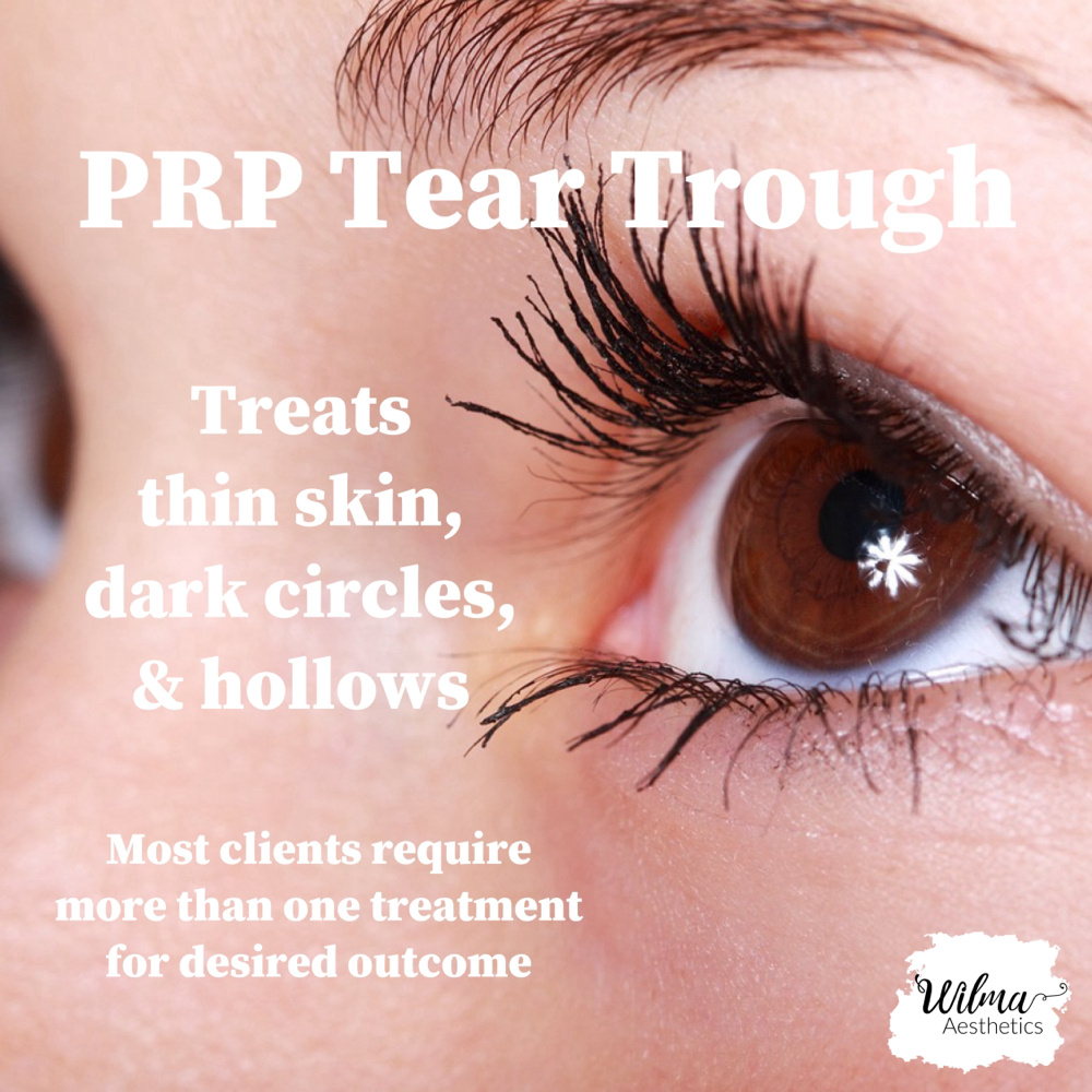 PRP Tear Trough Bundle Of 4