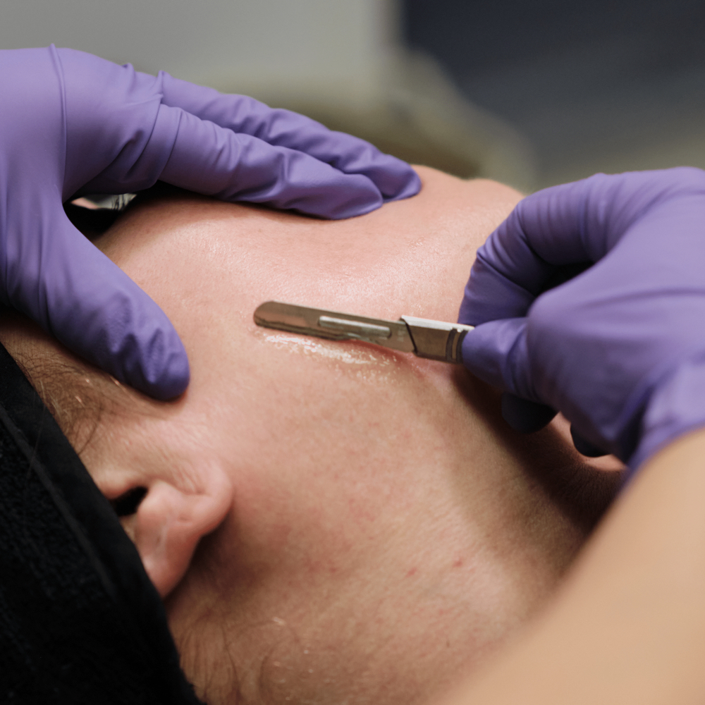 Dermaplane add-on at Eva Luna Wellness + Restore in Wauwatosa, WI