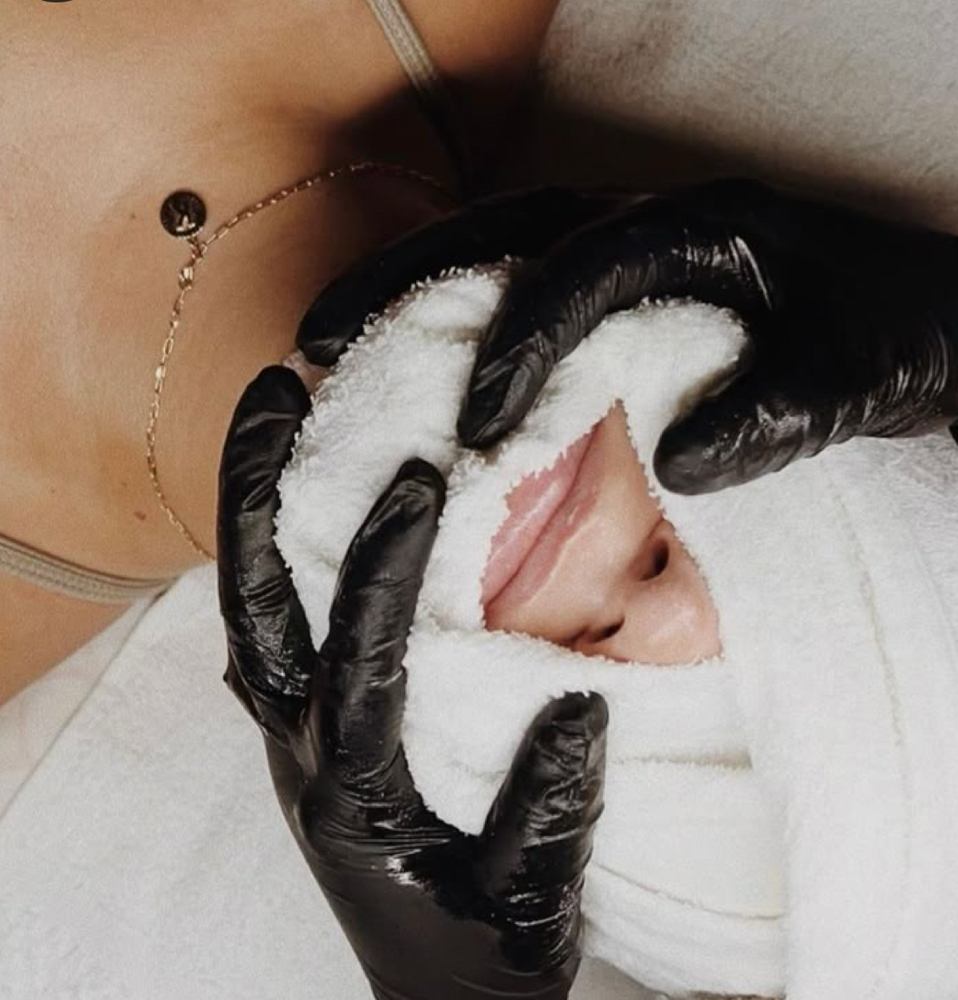 ACNE FACIAL