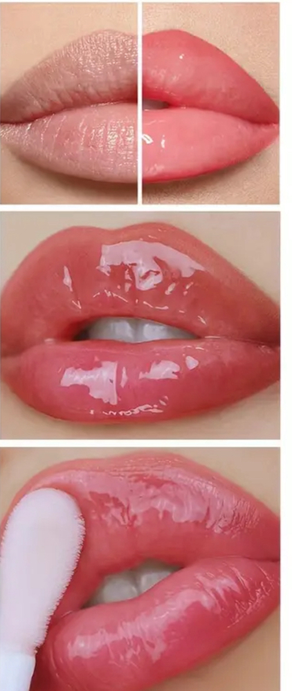 Hyaluron Pen Lip Filler