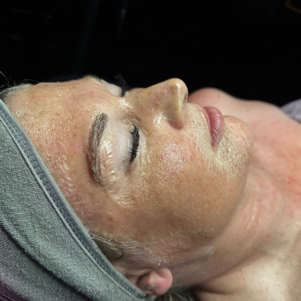 Glowtox Facial at Wildflower Beauty Lounge in Grandview, TX