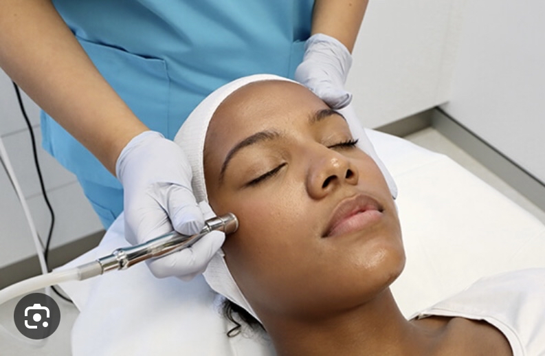 Microdermabrasion Facial