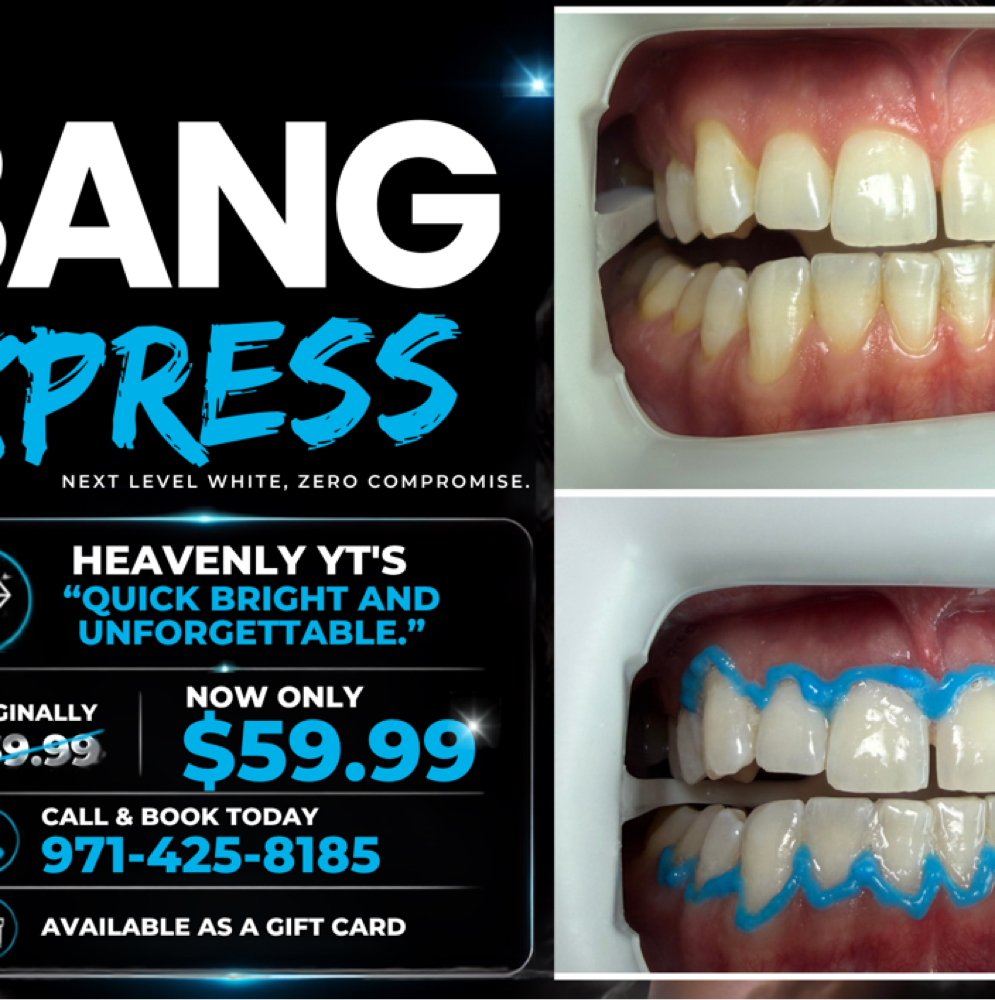 🚨XPRESS Bang - New Package Alert at Heavenly YT’s Teeth Whitening LLC in Portland, OR