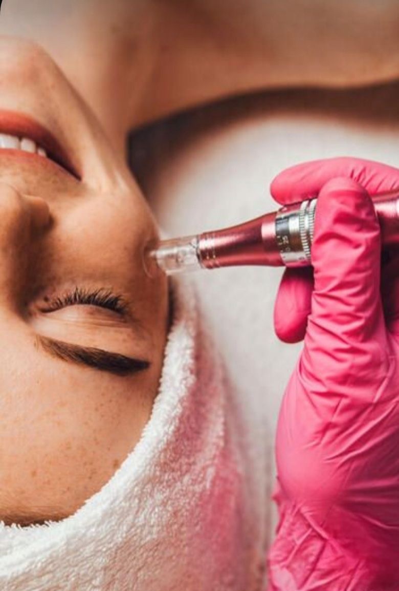 Microneedle