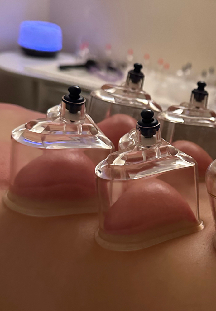 +Heart Shape Cupping Therapy
