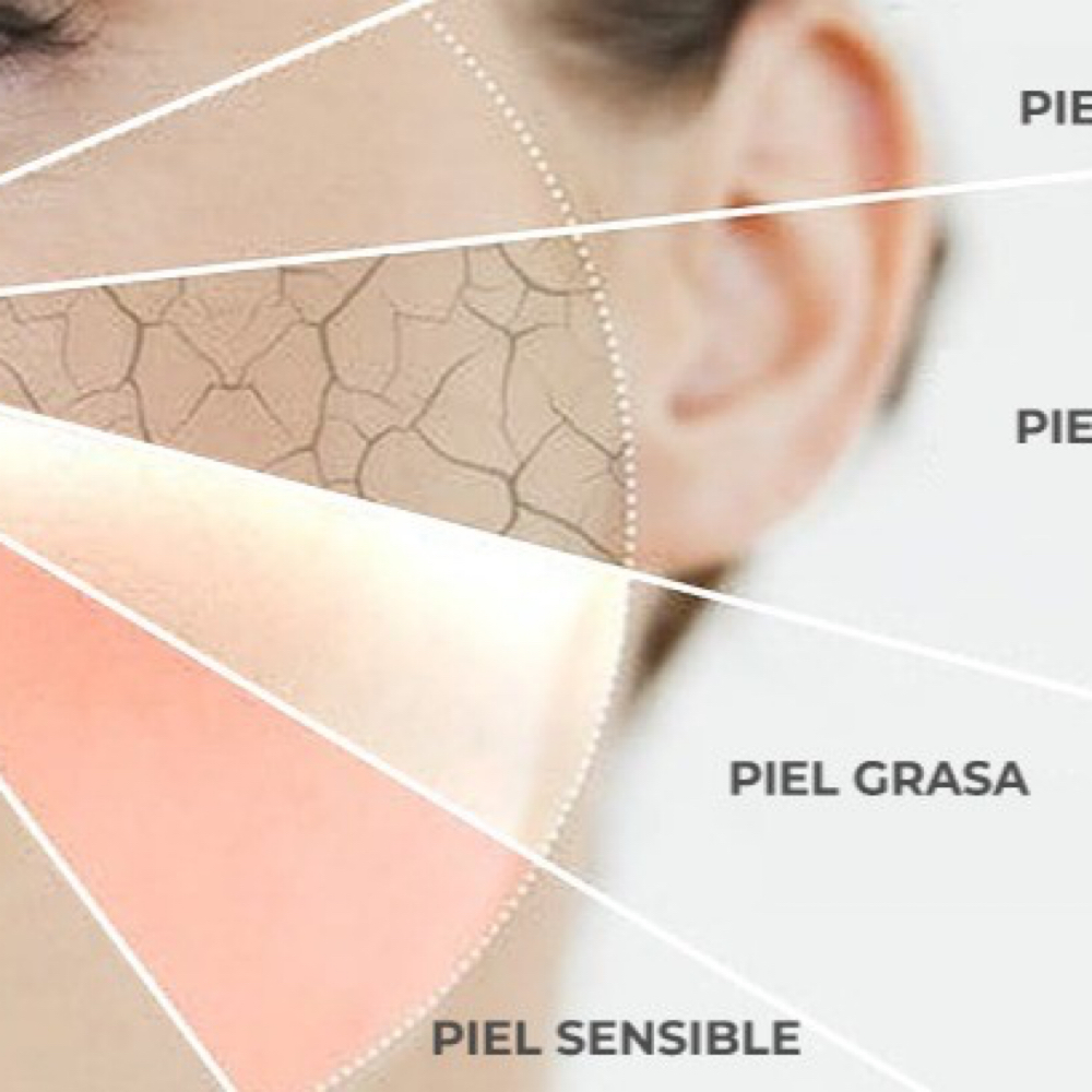 Consulta Profesional de Piel at International Esthetics Center in Summerville, SC