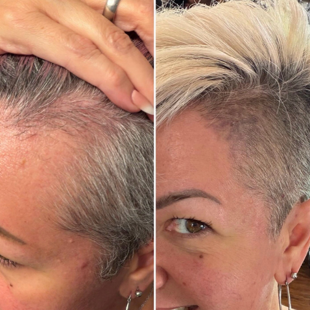 MicroVeil Scalp Shading Consult at The Hair Haven NSB in New Smyrna Beach, FL