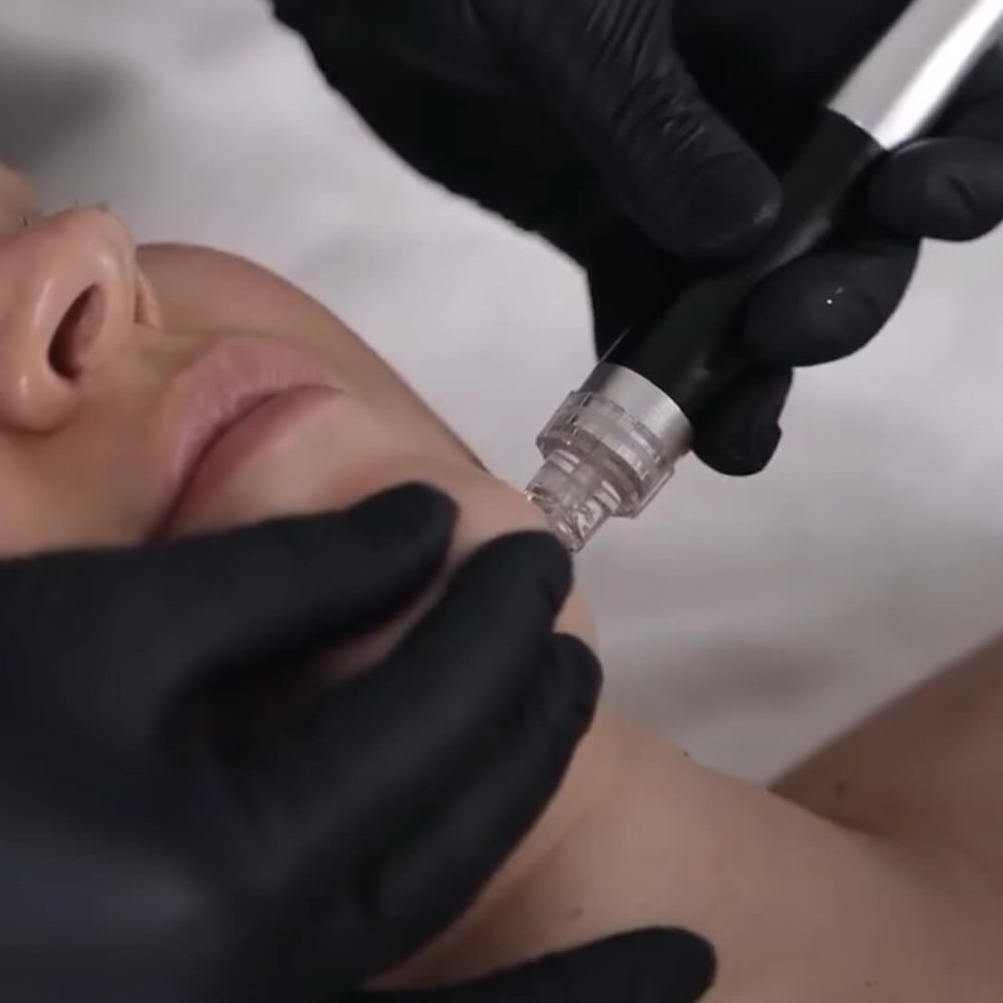 Deep Hydration Facial at Mj Esthetics in Kirbyville, TX